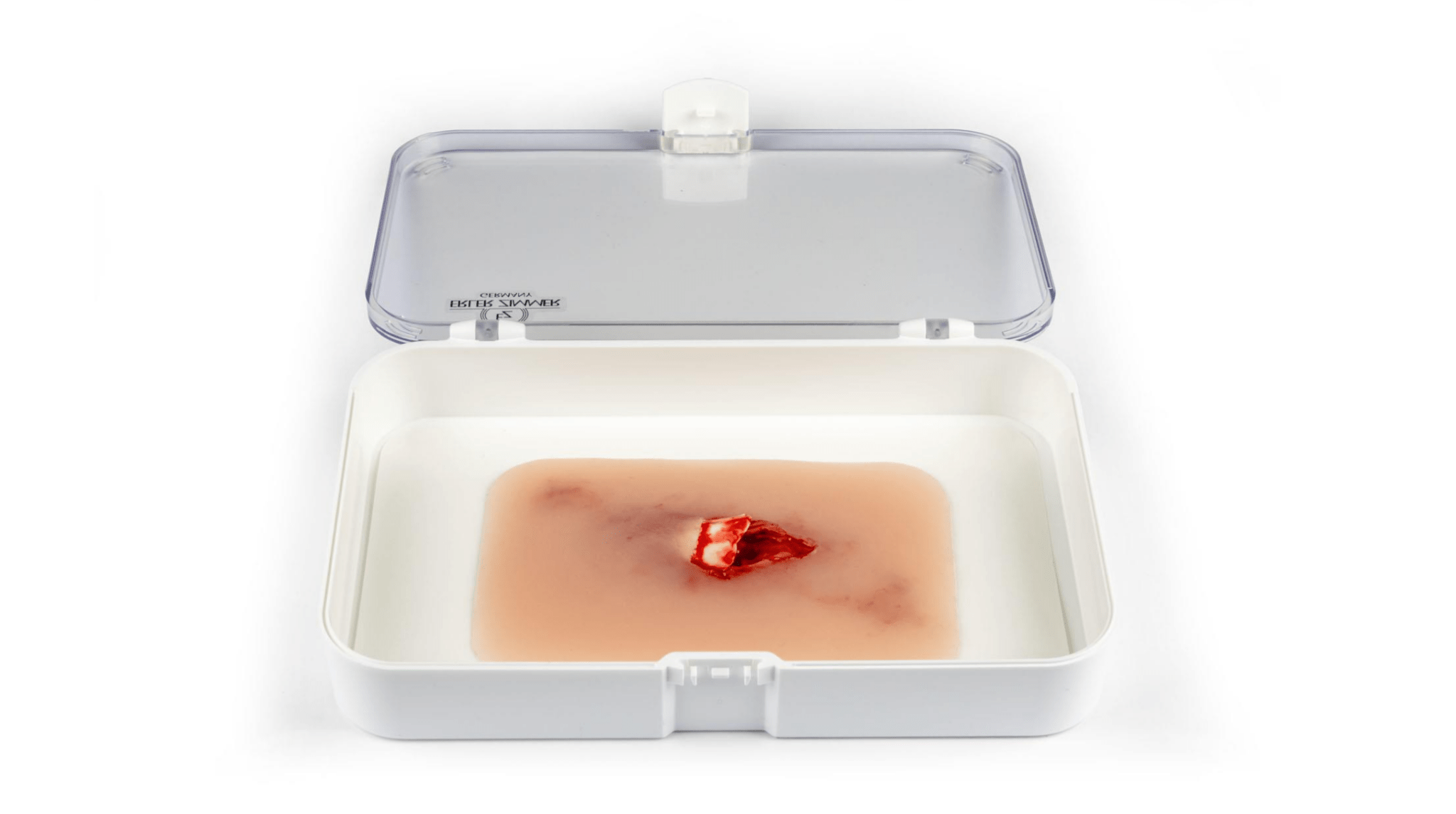 Wundmoulage offener Knochenbruch - Erler - Zimmer